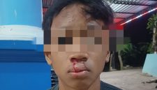 Korban penganiayaan mengalami luka cukup serius dibagian bibir.