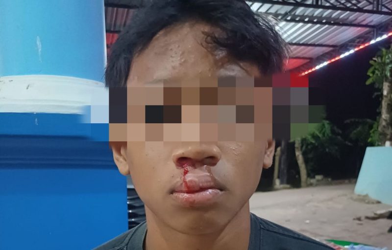Korban penganiayaan mengalami luka cukup serius dibagian bibir.