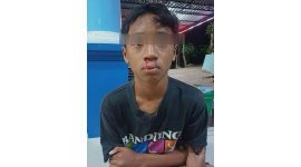 Korban yang masih berusia dibawah umur alami luka serius (Foto/Fan) 