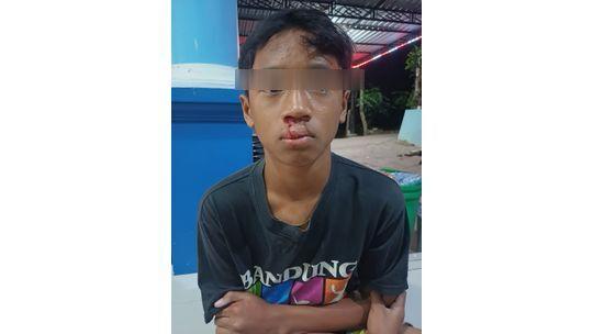 Korban yang masih berusia dibawah umur alami luka serius (Foto/Fan) 